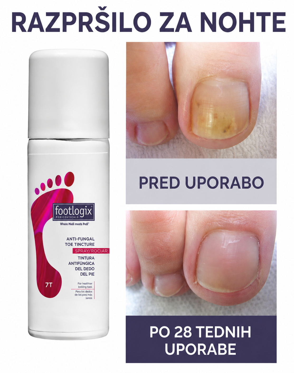 9ed44e5e-d548-46a7-b802-448386108c02 Footlogix tinktura proti glivicam na nohtih - slika 2